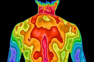 Back thermogram
