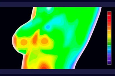 Boise breast thermography options in ID near 83713